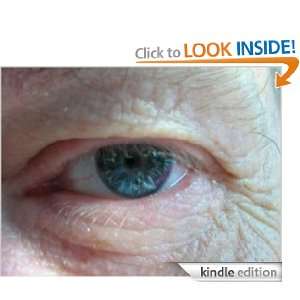   Wrinkles and Look Years Younger eBook Wrinkle Remover Kindle Store