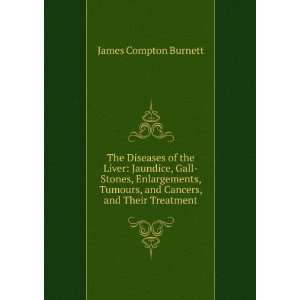   , and Cancers, and Their Treatment James Compton Burnett Books