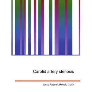  Carotid artery stenosis Ronald Cohn Jesse Russell Books