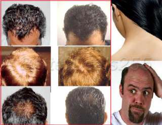 Laser Treatment Power Grow Comb Kit Stop Hair Loss Regrow  